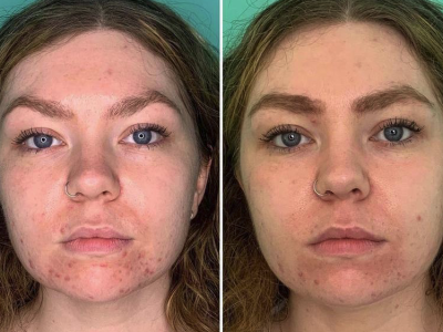 Screenshot 2025-03-05 at 2.36.51 PM